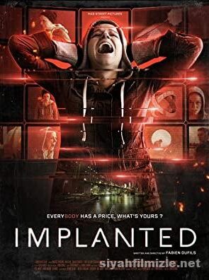 Implanted