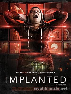 Implanted